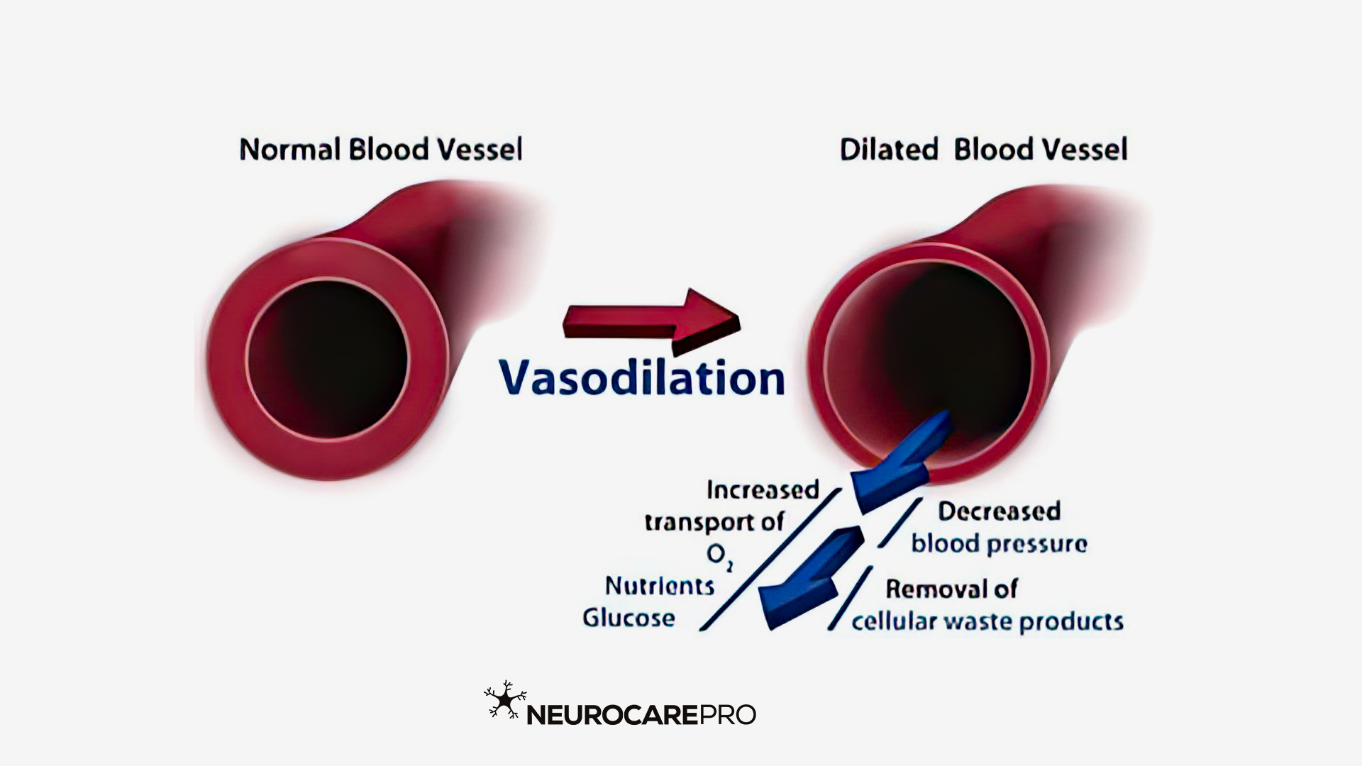 Vasodilation Natural Vasodilator