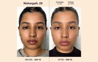 face and skin before and after with red light therapy
